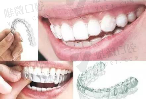 种植牙与假牙区别是什么,种植牙装牙冠疼哭(图1)
